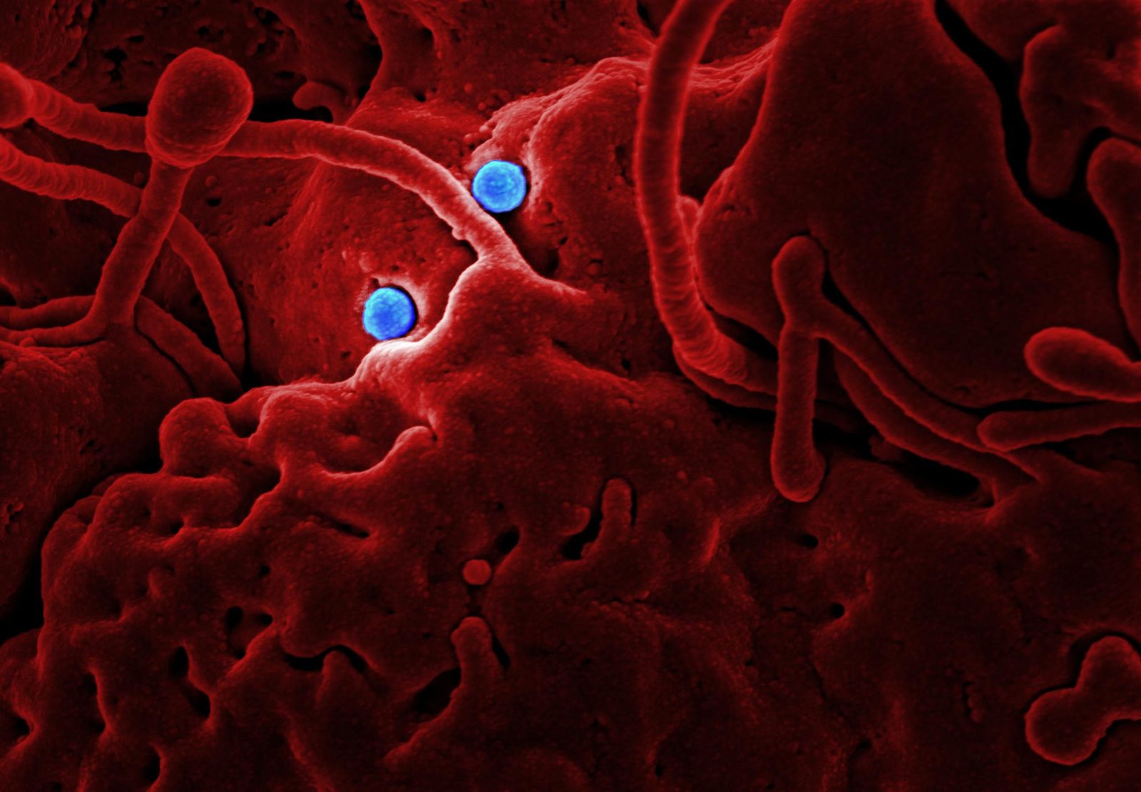 Immagine al microscopio elettronico di un virus influenzale colorato artificialmente
